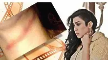 Актриса на косъм от смърт чрез обесване по време на снимки