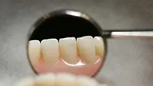 Учени създават метод за лечение на зъбите без пломби