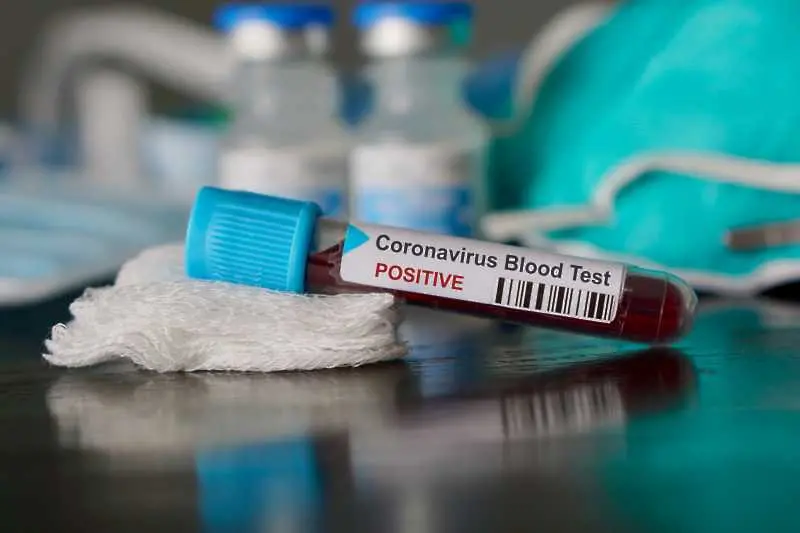 Потвърдените случаи на коронавирус у нас са 412