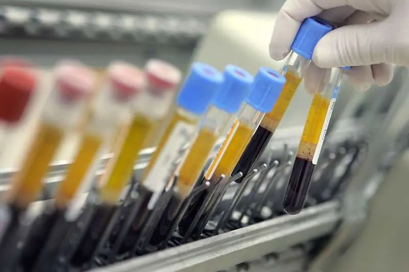 Пациенти с положителен антигенен тест без право на безплатен PCR