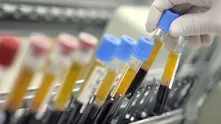 28 случая на тромбози след ваксината на Johnson&Johnson в САЩ