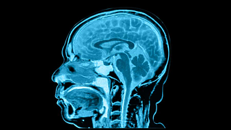 Човешкият мозък е нараснал с почти 7% за половин век